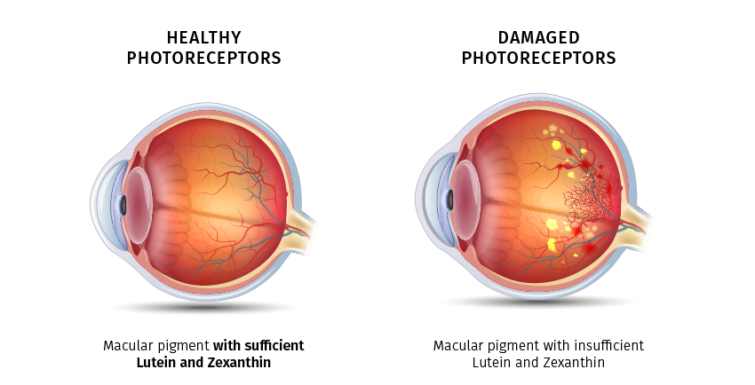 Eye PROtect 1+1 FREE