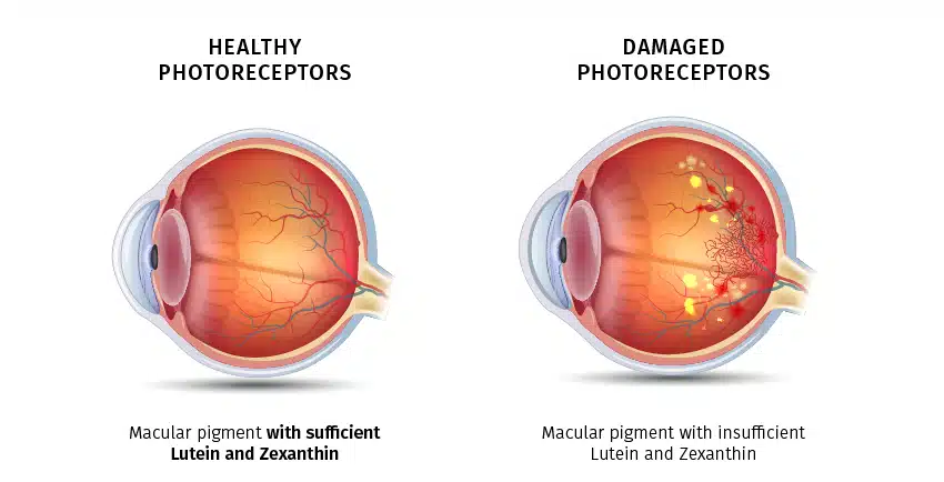 Eye PROtect 1+1 FREE